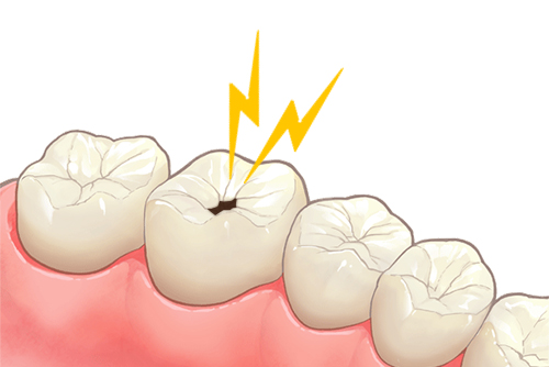 歯が痛む